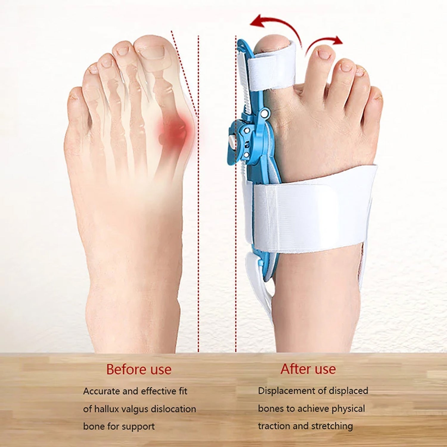 12738 Bunion Support Splint. Valgus And Bunion Valgus Corrector Hallux Valgus Corrector Adjustable Bunion Valgus Protective Cover For Men And Women Wukusy